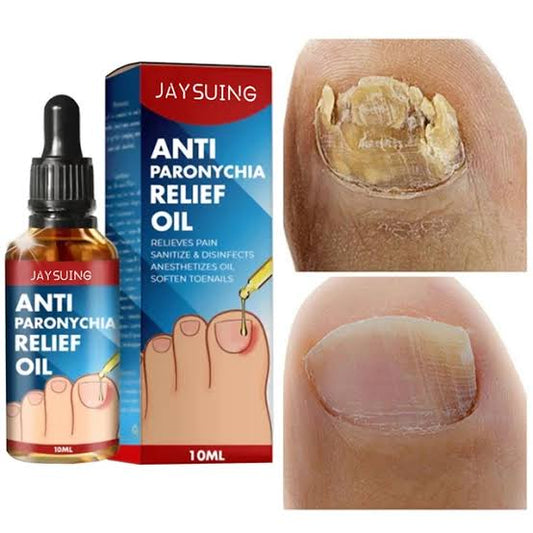 ELIMINA HONGOS EN LAS UÑAS + ENVIO GRATIS